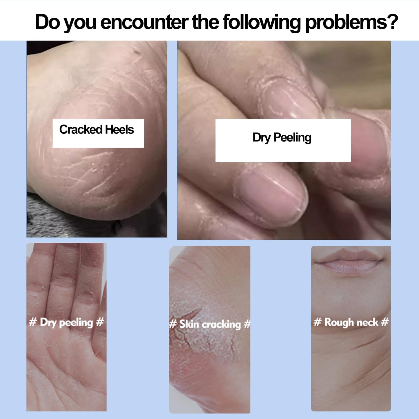 Equrhsa Foot Care Cream Cracked Feet, Eourhsa Crack Feet Prevention Stick, Equersha Foot Balm, cracked Heel Stick Balm, Anti Cracked foot Cream for Dry Heels, Hydrating and Smoothing (Pink, 1)