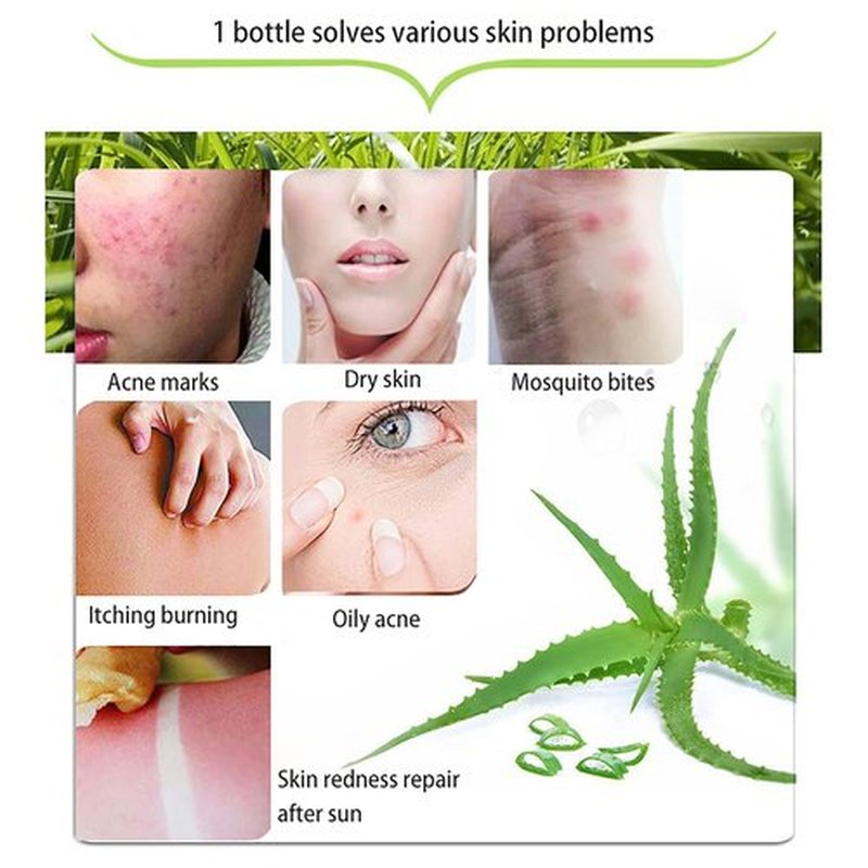 ASYBO 300 ML Natural Aloe Vera Gel -Organic Moisturizing Cream, Soothing and Hydrating, Sunburn and Scar Repair, Care for Face Body Hair