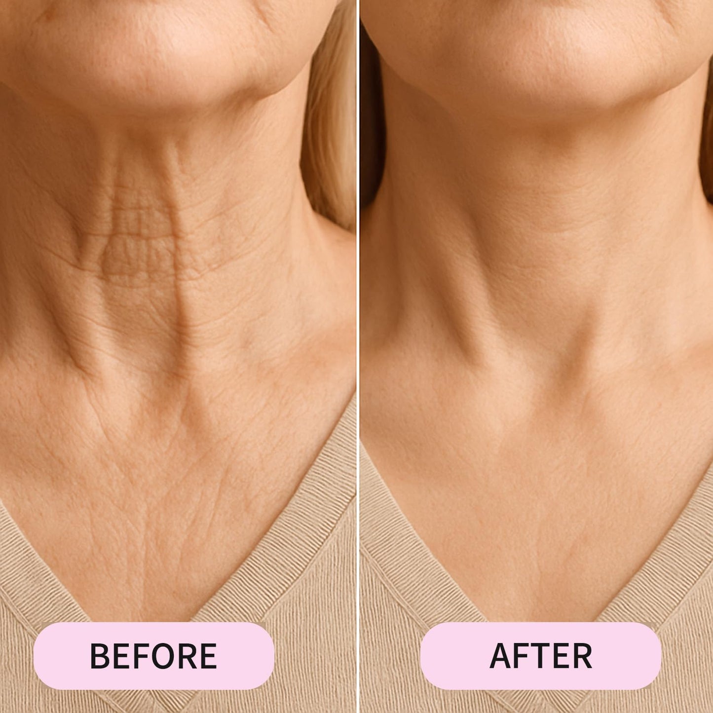 Celestica Neck Tape, Celestica Instant Neck Tape, Firming & Lifting Invisible Celesticaco, Ultra Lifts for Jowls Tightening (1 Set: 4 Strips + 20 Patches, 20 cm)