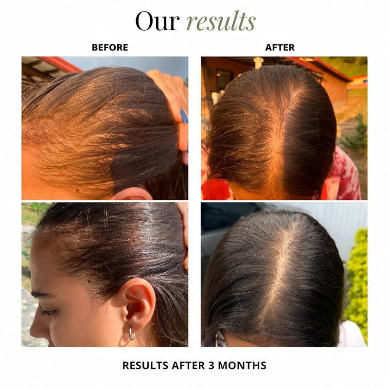 BUNDU Hair Growth Supplements – 90 Soft Capsules for Fuller Hair & Reduced Shedding