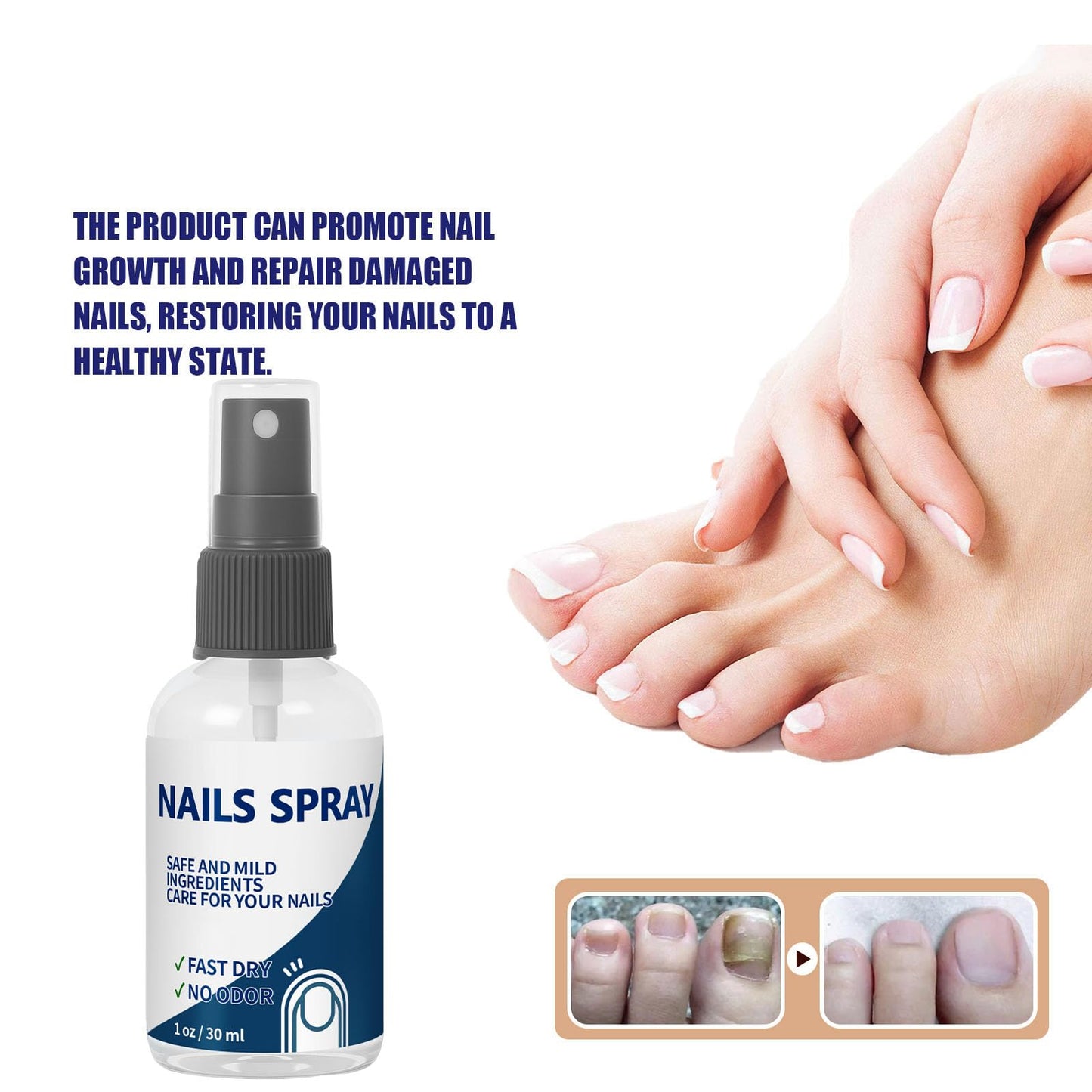 Nails Spray, for Nails Care Moisturizer, Keeps Feet Fresh & Dry All Day – Men & Women 2oz / 60ml
