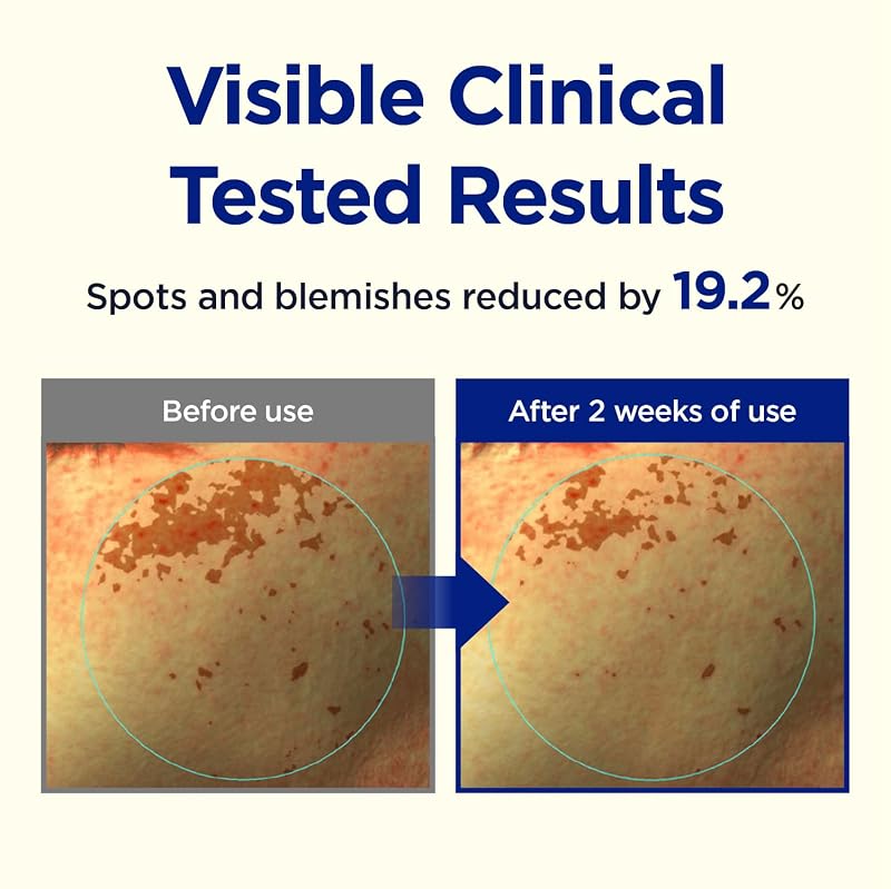 Vitamin C TECA Blemish Under Eye Gel Patches, 60 Count