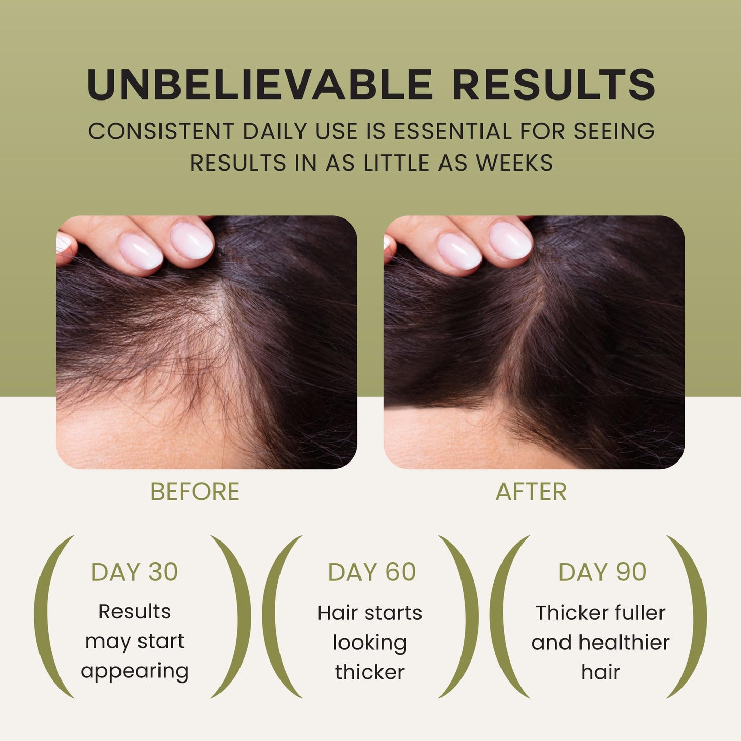 Lebanta Batana Oil For Hair Growth - 100% Pure, Raw & Natural Blend With Organic Castor, Pumpkin Seed, Coconut and Rosemary Oil - Thicker, Stronger Hair For Men & Women Scalp (1 Pack)