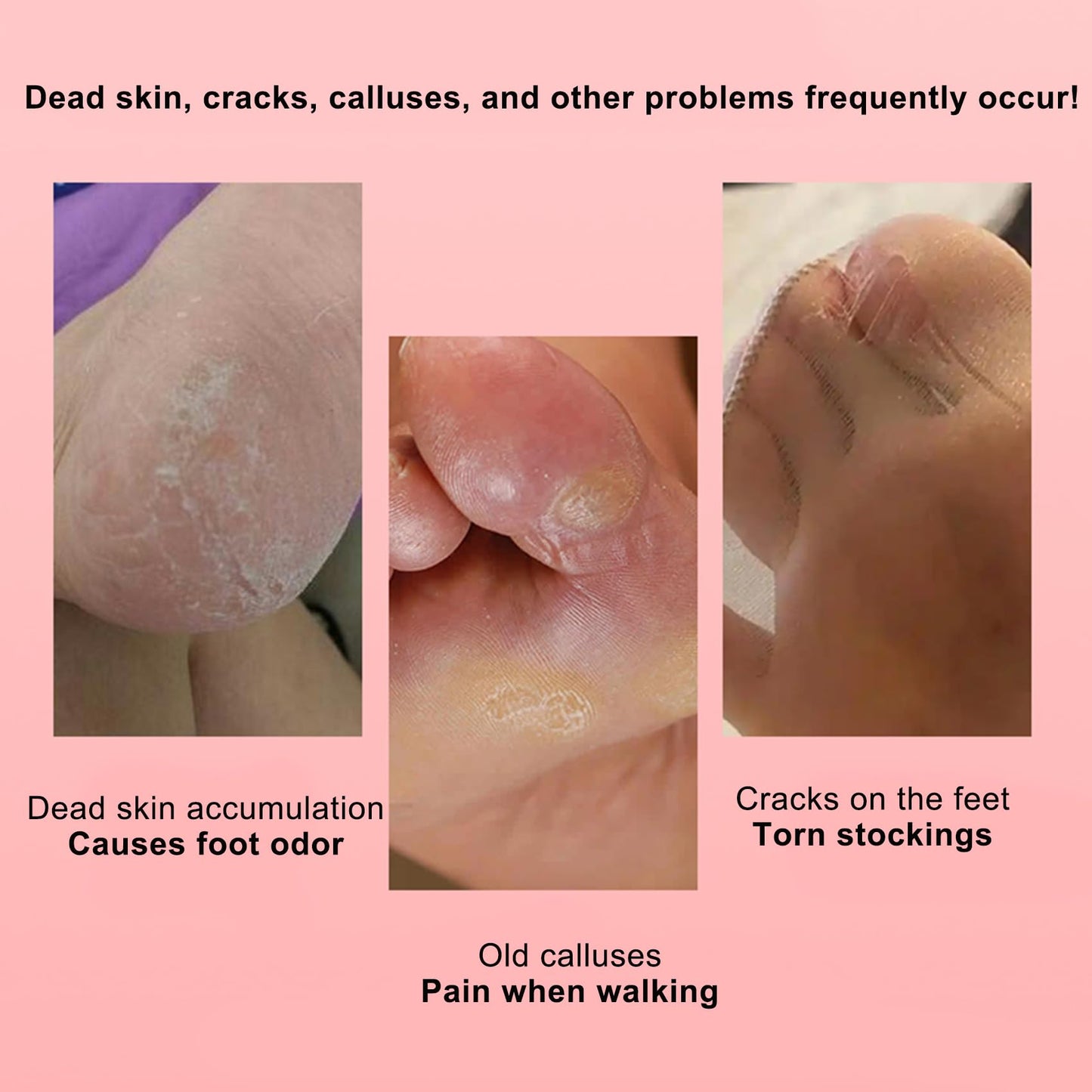 Avalaine Electric Foot Callus Remover, 2025 Upgraded Rechargeable Pedicure Tool, The Original Electric Callus Remover, Adjustable Speed, for Dead Skin & Cracked Heels, for Men & Women (Gray)