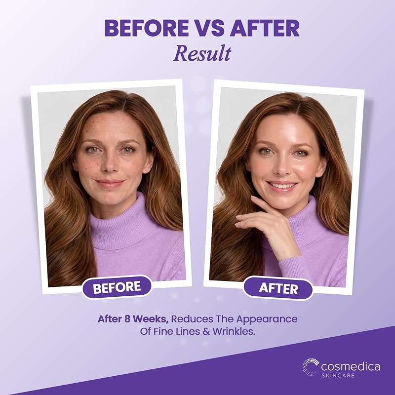 Peptide Serum with Matrixyl 3000 & Hyaluronic Acid – 2oz, Anti-Aging Facial Serum