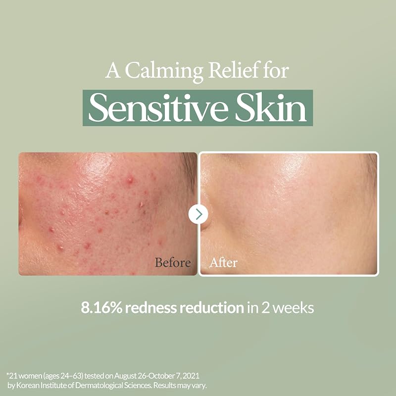 Calming Repair Serum with Centella Asiatica & Madecassoside 1.69 fl oz