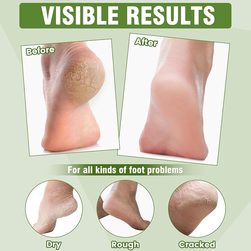 Moisturizing Foot Mask with Shea Butter & Jojoba Oil - 36 Pairs (Variation: Shea Butter+36 Pairs)