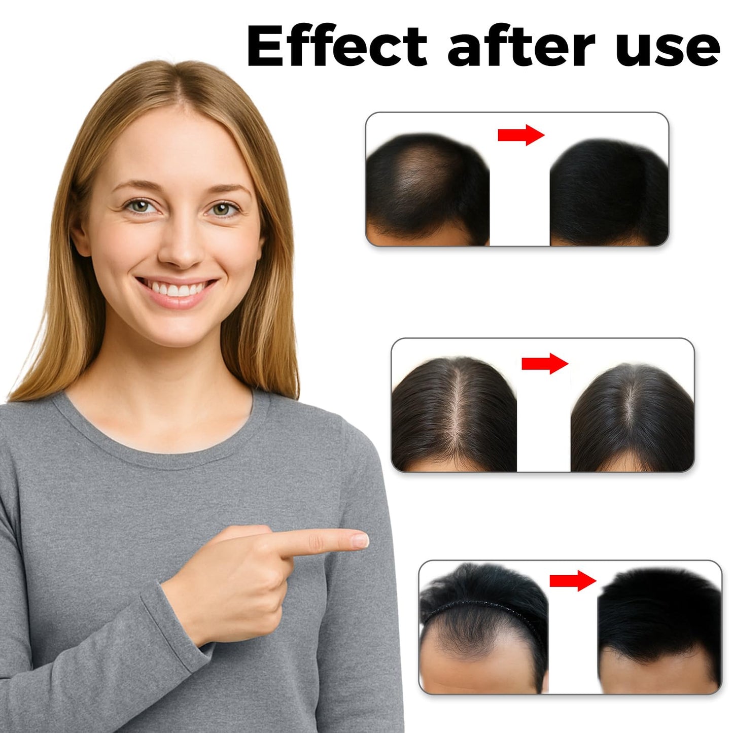 Laser Hair Growth Cap,Hair Growth Device - LS-D620， Advanced Laser Hair Growth Cap, red light therapy for hair growth