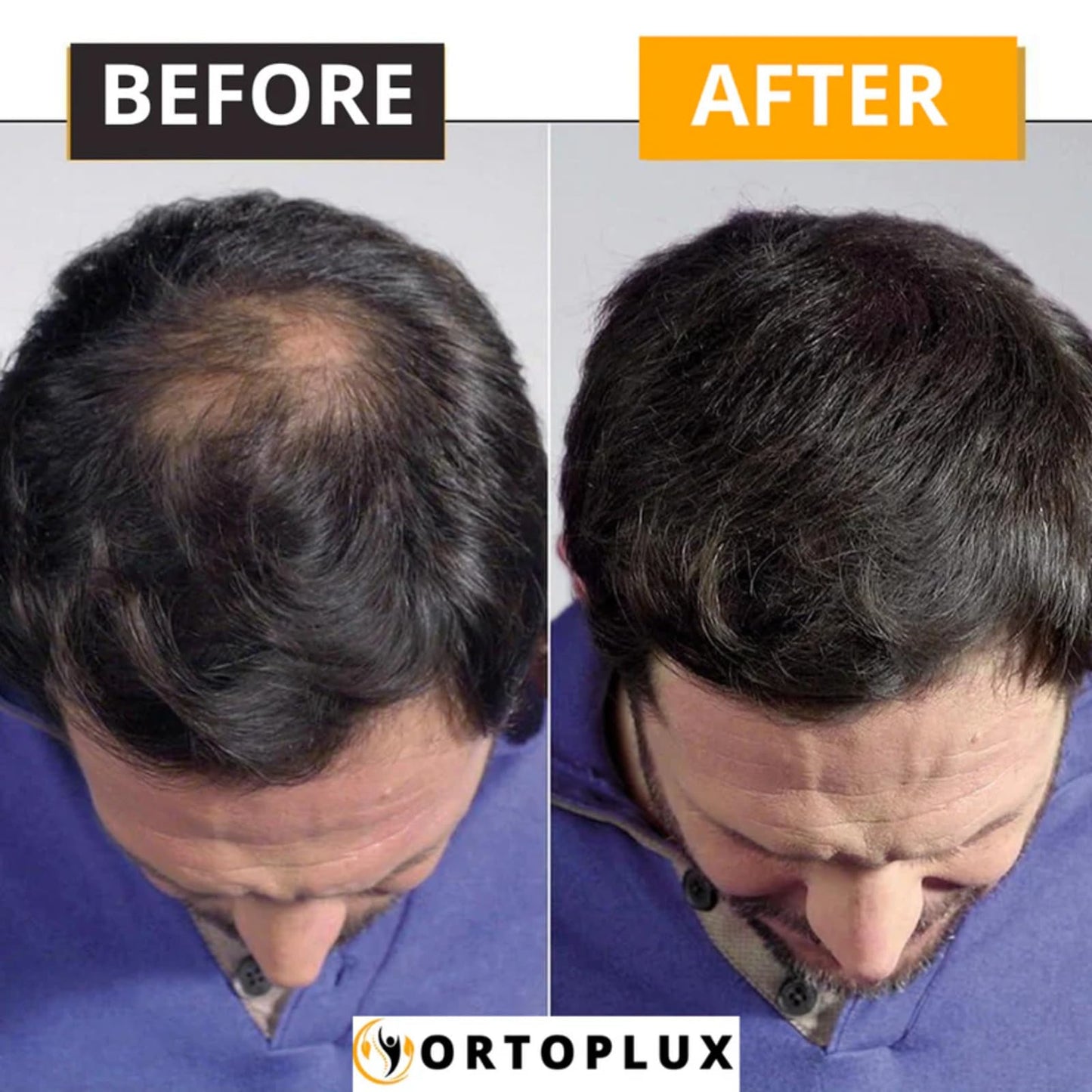 Ortoplux Hair Density Filler, Ortoplux Hairline Powder, Ortoplux Hairline Root Touch Up, Sweatproof Waterproof Hair Powder with Mirror (Light Brown)