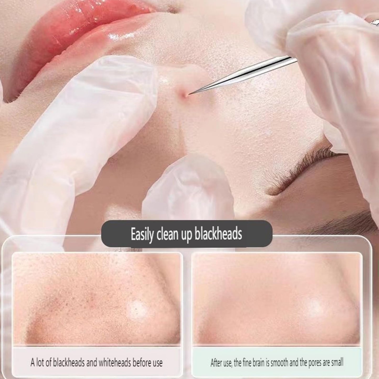 Classicous Blackhead Remover Tools, Blackhead Remover Tools, Stainless Steel Blackhead Remover Kit, Pimple Popper Tool Kit, Extraction Tools for Estheticians (11pc)