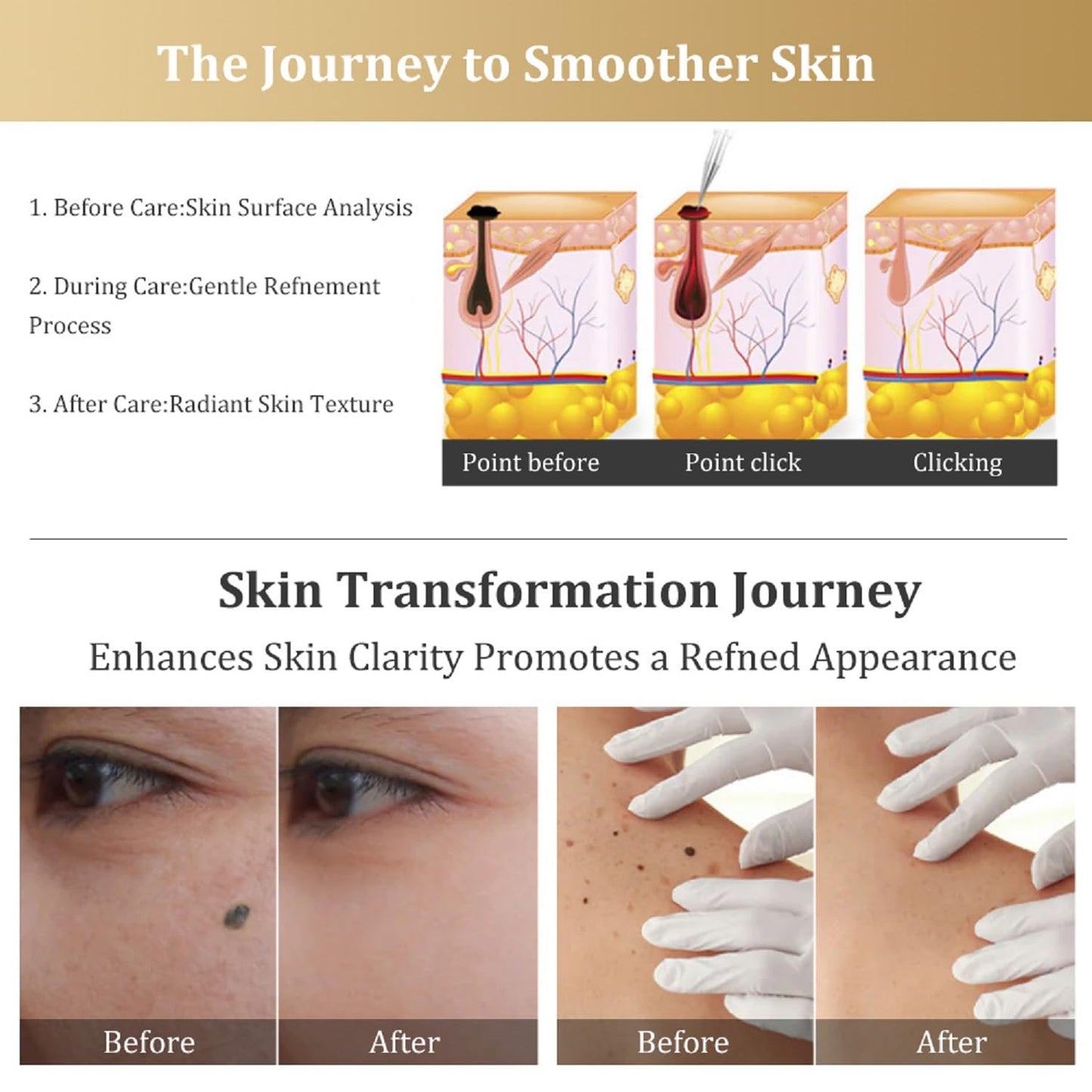 Gentle Skin Surface Maintenance Tool for Daily Skin Care, Suitable for Adults (Gold and White)