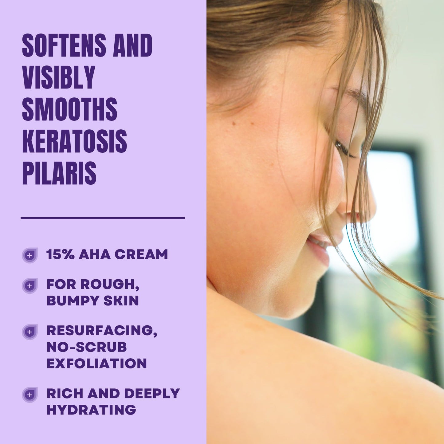 AmLactin KP Bumps Be Gone - 3 oz Keratosis Pilaris Moisturizing Cream with 15% Lactic Acid - Exfoliator and Moisturizer for Dry, Rough and Bumpy Skin (Packaging May Vary)