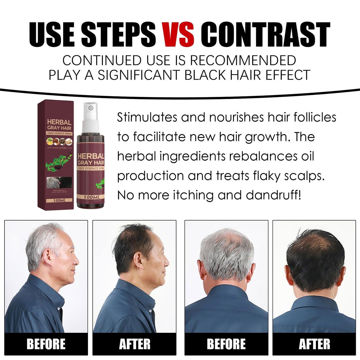 Herbal Essence Hair Spray, Hair Darkening Conditioner Spray, Herbal Hair Coloring Spray, Gray Hair Reverse Herbal Essence Spray, Reverse Grey Hair,100ml (1)