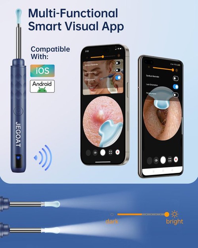 Ear Wax Removal Tool Camera, Ear Cleaner with Camera, Ear Cleaning Kit 1296P HD Ear Scope, 6 LED Lights and 12 Ear Picks, Earwax Removal with Otoscope to Earify Earwax for iOS and Android