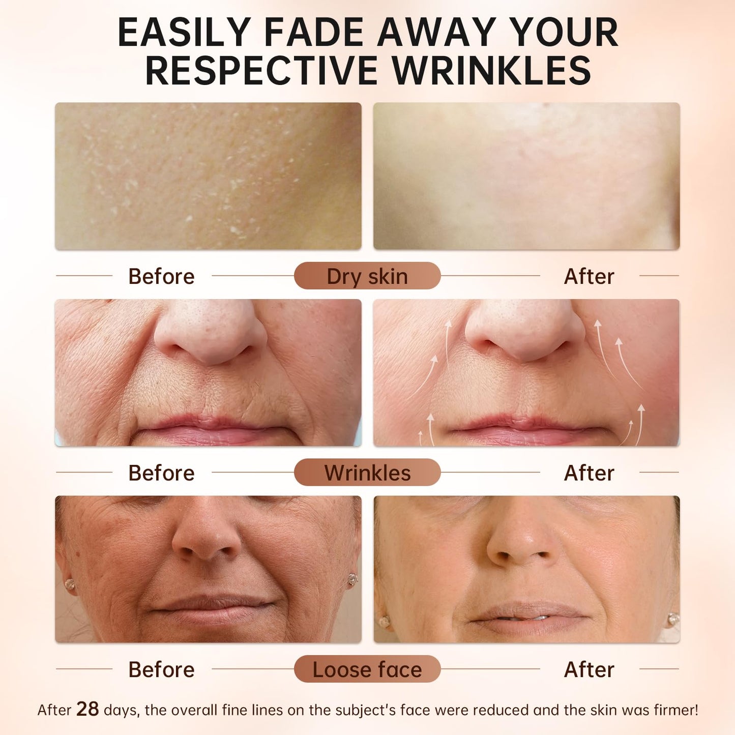 VGO Retinol Serum for Face, Resurfacing Retinol Serum with Hyaluronic Acid, Niacinamide and Ceramides, Hydrating and Refreshing, Wrinkle Smoothing, Suitable for Sensitive Skin (1 pack)