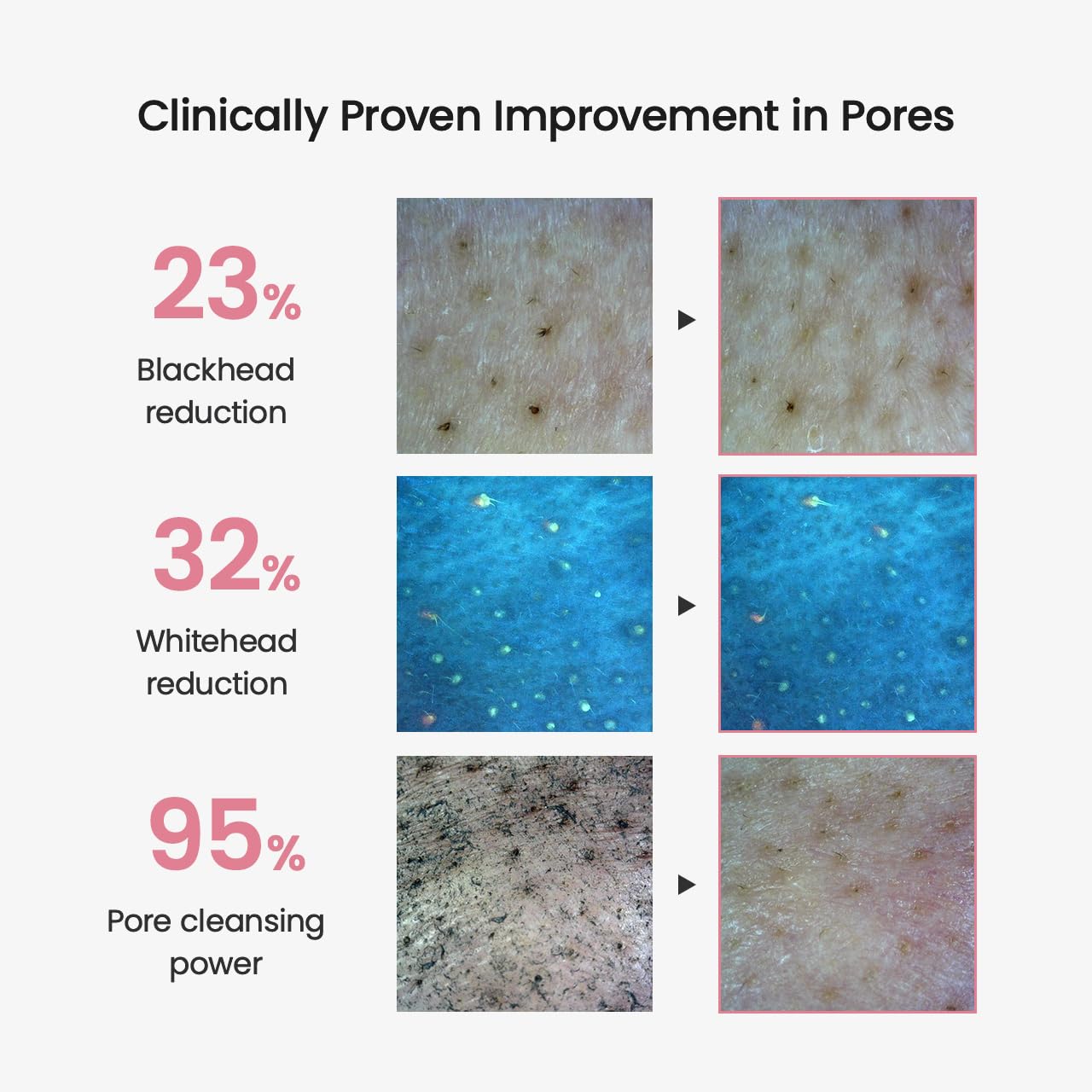 BIODANCE Collagen Cleansing Oil, Facial Oil Cleanser, Gentle Makeup Remover without Clogging Pores, Removes Bleackhed and Whitehead for Sensitive Skin, Oily Skin, 6.76 fl. oz. (200 ml)