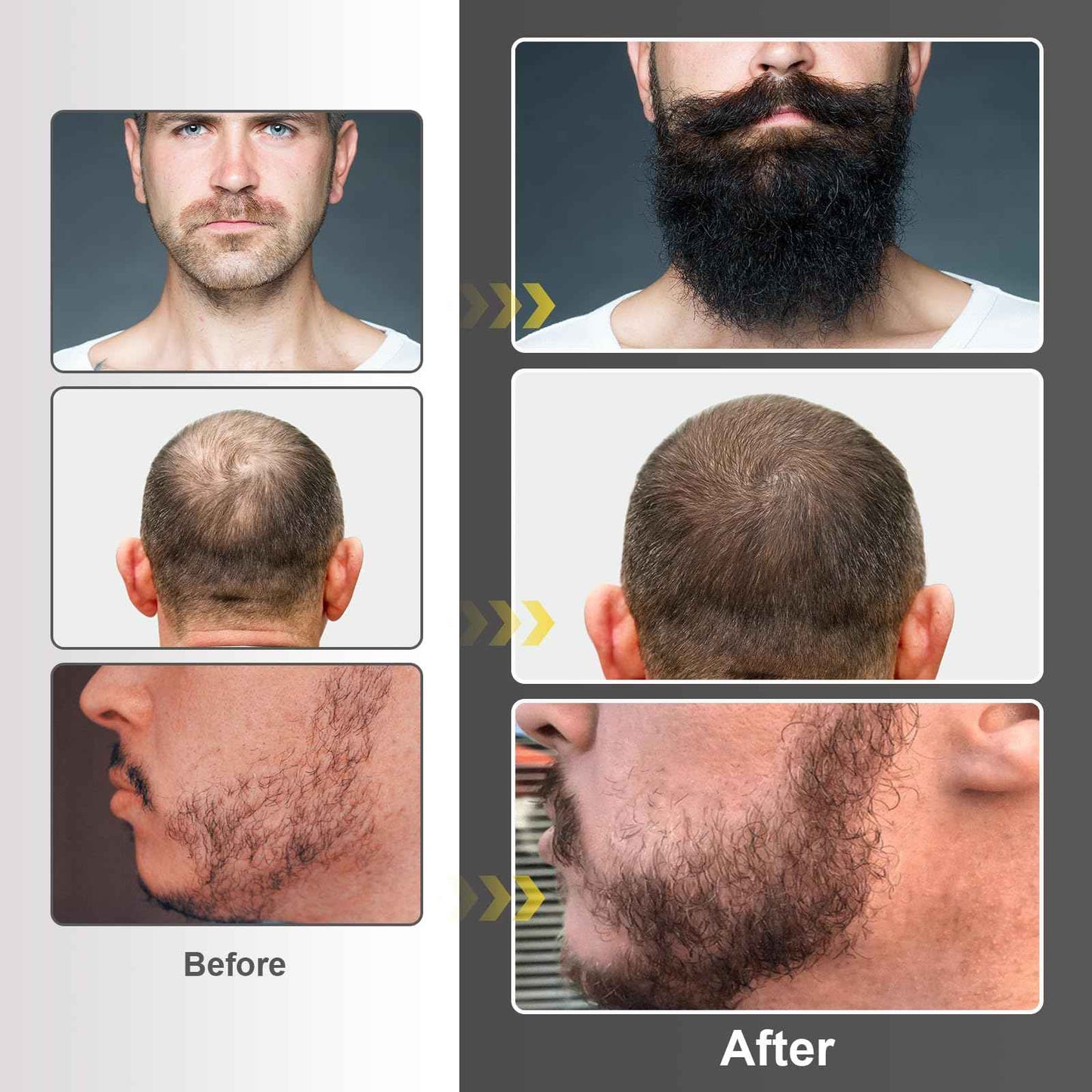 Beard Growth Kit - Beard Kit for Men with Beard Growth Oil (2oz), Beard Balm, Beard Comb, Massager for Spot/Patchy Beard - Christmas, Anniversary, Birthday for Men, Dad, Husband, Boyfriend