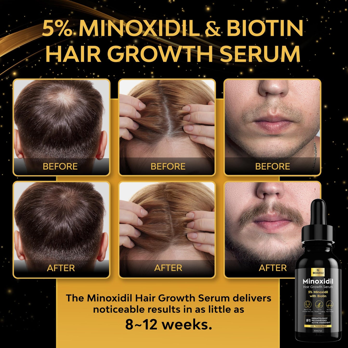 beaueli 5% Minoxidil for Men Hair, Minoxidil for Women Hair Growth, Minoxidil for Men Beard Growth, Minoxidil 5 Percent, Hair Regrowth for Men, Hair Loss Treatments for Women 1oz