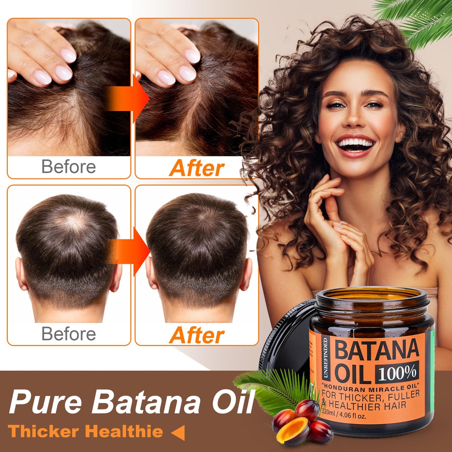 Raw Batana Oil for Hair Growth Dr Sebi, 100% Pure Organic Batana Hair Mask from Honduras, Wild Growth Hair Oil, Scalp Oil Promotes Hair Thickness, Prevents Loss for Men & Women, 4.06 fl oz (1 Pack)