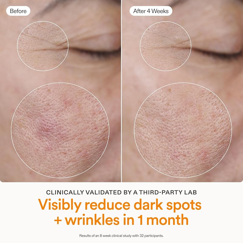 Vitamin C Serum for Face 15% THD Ascorbate | Brightens & Firms Skin