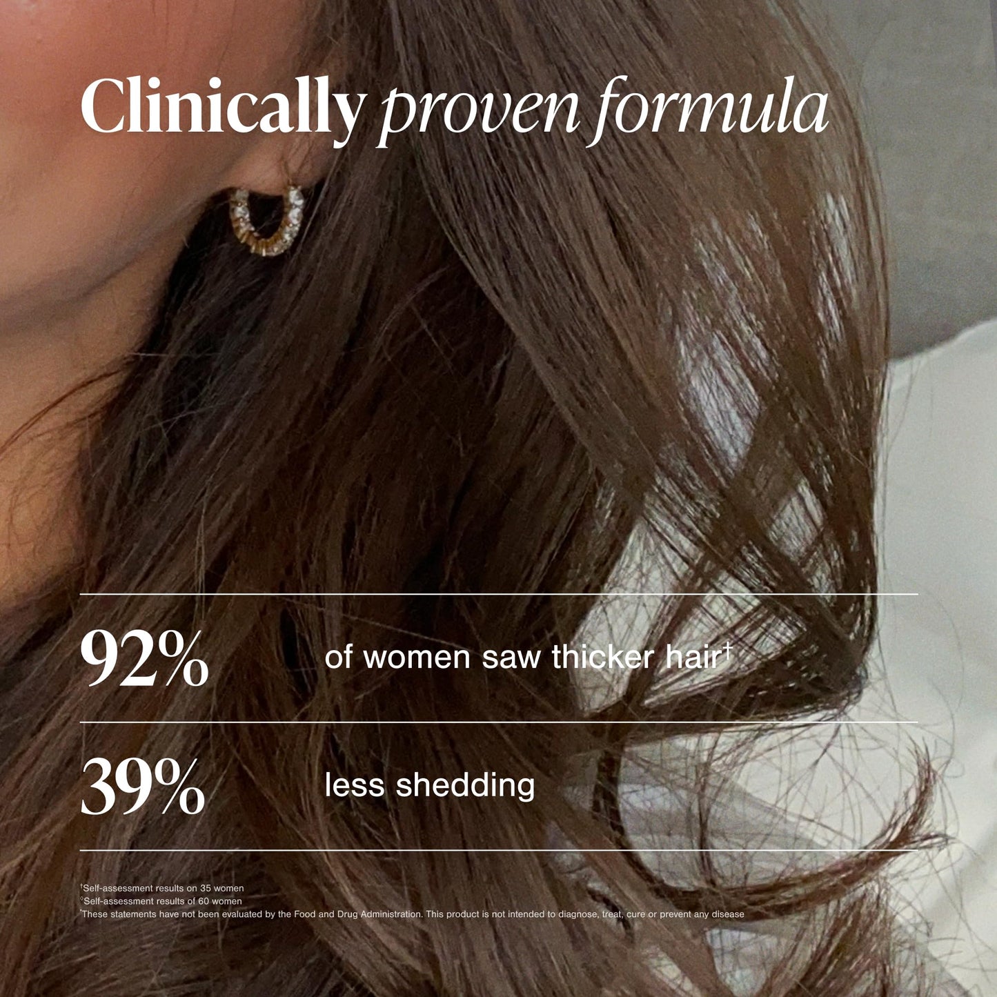Viviscal Hair Growth Supplements For Women For Thicker, Fuller Hair, Nourishes Thinning & Loss, With Proprietary Collagen Complex, 180 Tablets, 3 Month Supply