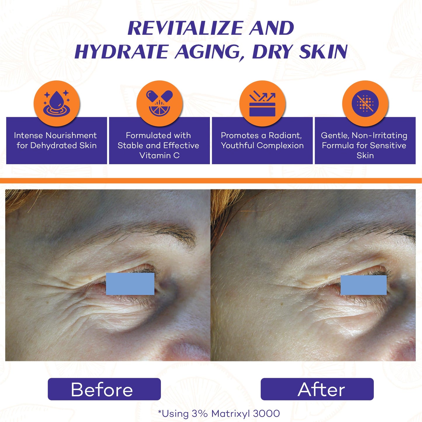 Vitamin C Face Oil Serum – 5% Oil-Soluble Vitamin C (THD Ascorbate) & Peptide Complex (Matrixyl 3000) – Hydrating with Squalane, Rosehip & Pomegranate – For Dry or Mature Skin– 1 fl oz