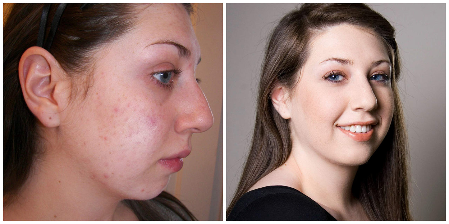 Judith August - EraseZit Deluxe Pencil - (Neutral)