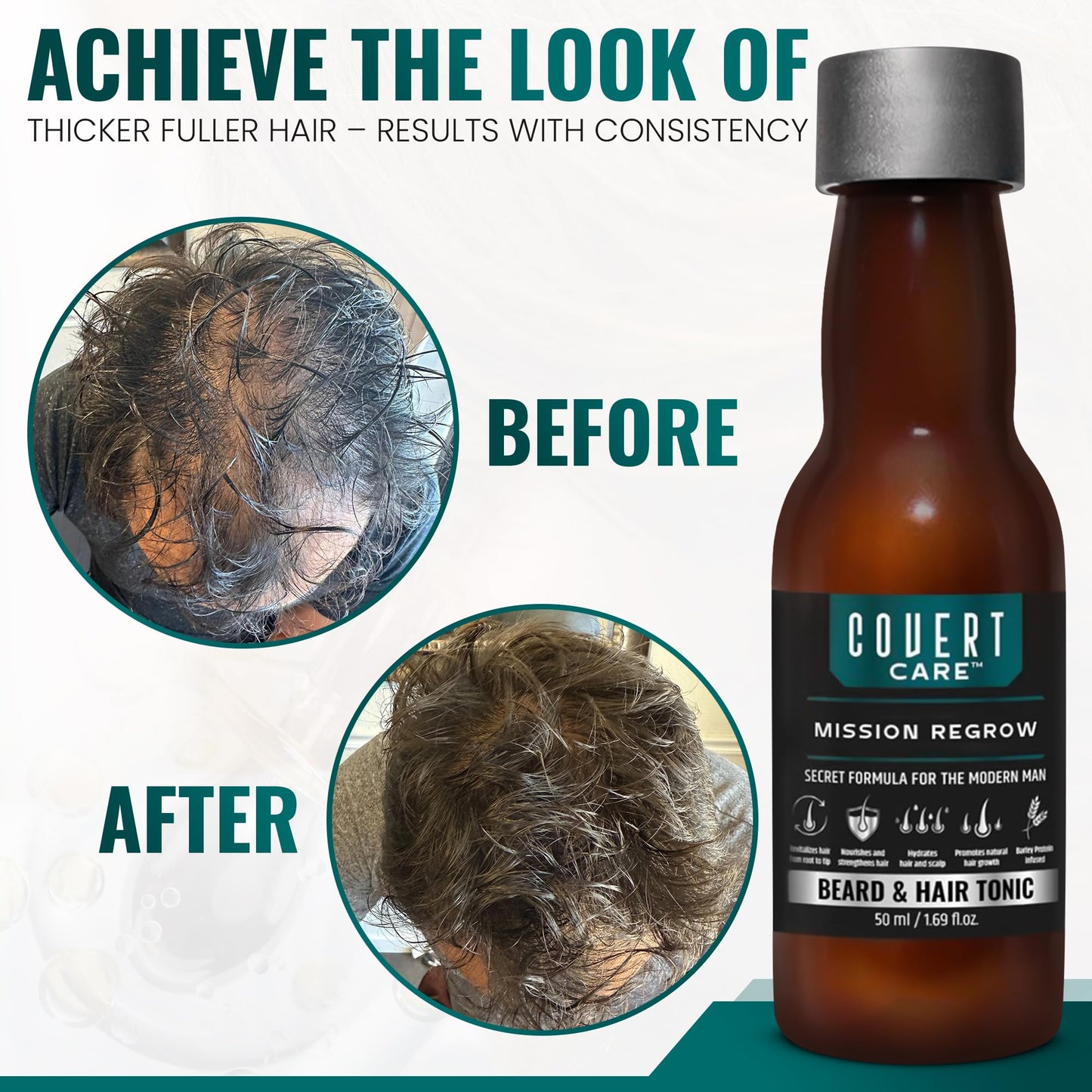 Hair and Beard Thickening Serum for Men – Lightweight Root Activator for Thinning Hair, Scalp Nourishment for Fuller, Stronger-Looking Hair