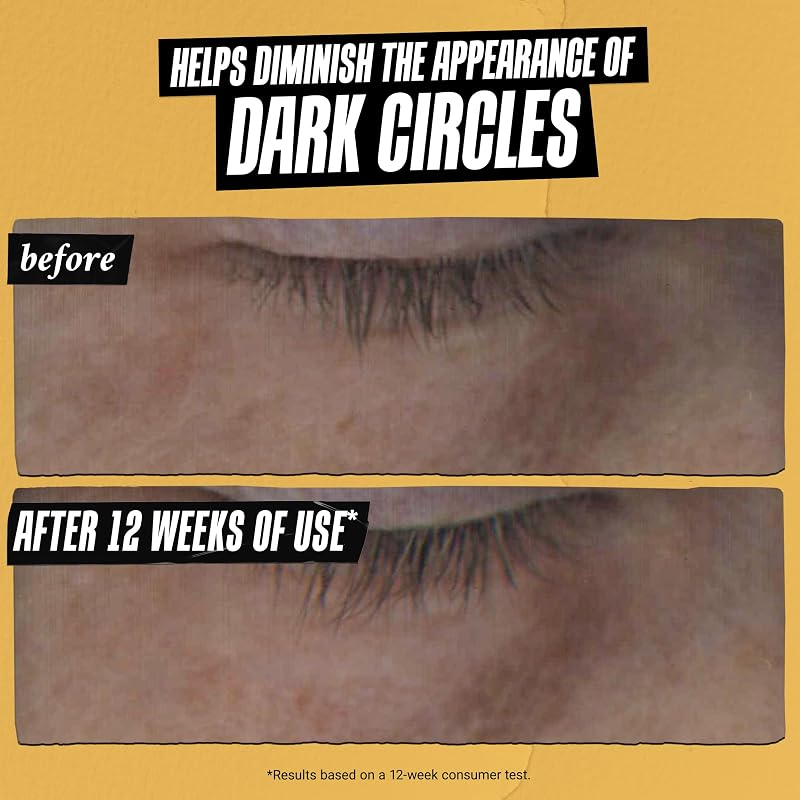 Powerful-Strength Vitamin C Eye Serum for Dark Circles, 0.5 fl oz