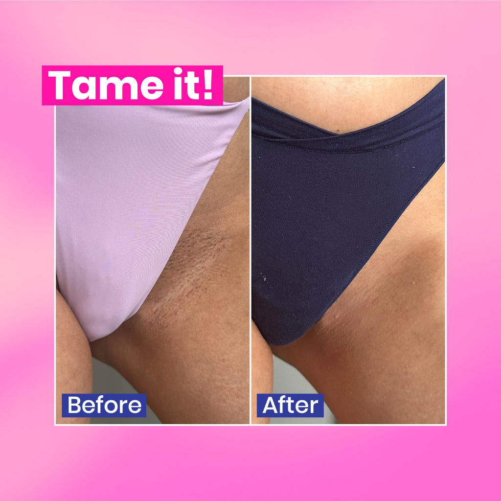 WooWoo - Tame It! In-Shower Natural Hair Removal Depilatory Cream | No Irritation Vegan Hair Remover For Sensitive Skin - Legs, Bikini, Intimate Areas (3.4 oz | 100 ml)