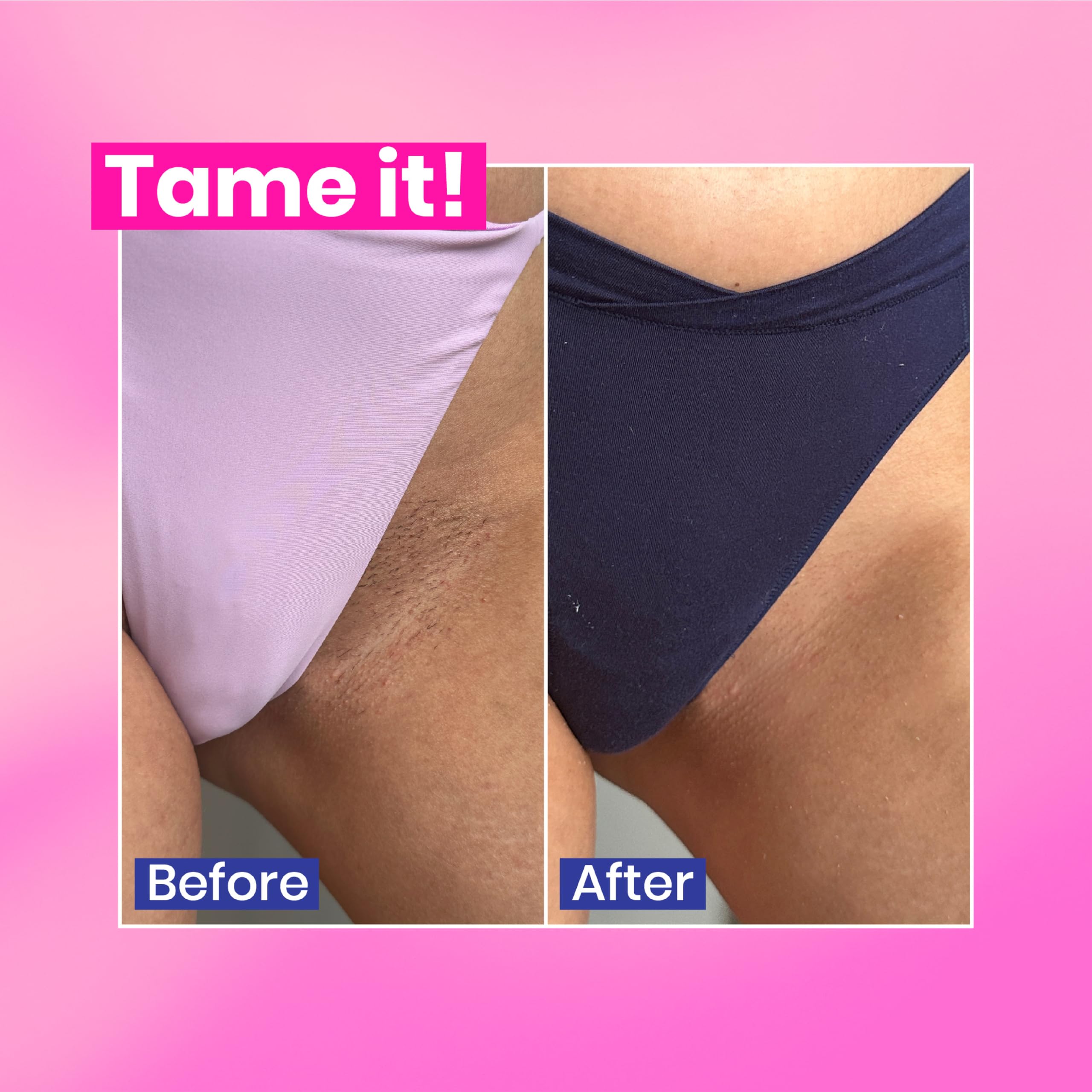 WooWoo - Tame It! In-Shower Natural Hair Removal Depilatory Cream | No Irritation Vegan Hair Remover For Sensitive Skin - Legs, Bikini, Intimate Areas (3.4 oz | 100 ml)