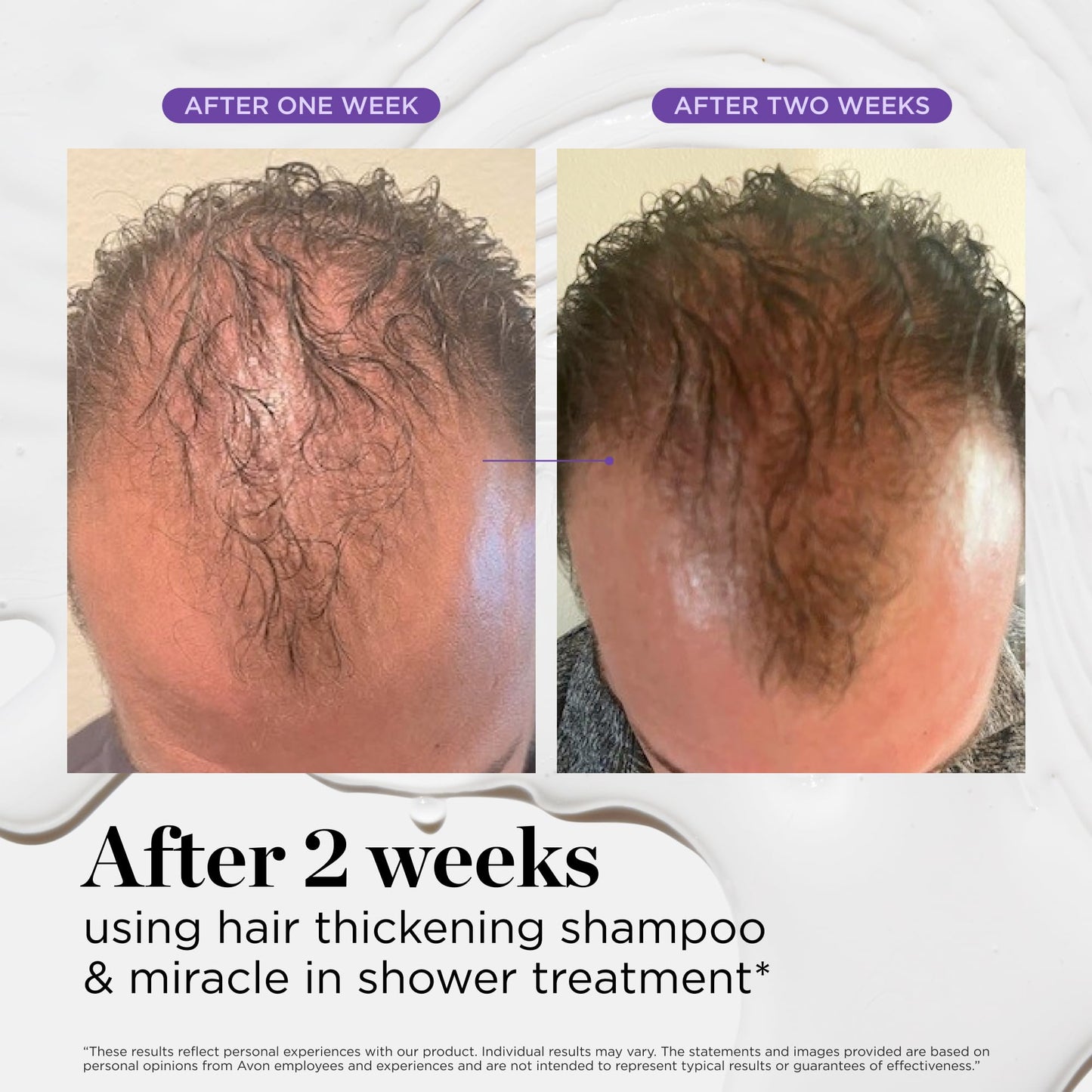 Dr. Groot Miracle in Shower Treatment for Hair Loss, Korean Hair Care, 5 Seconds to Smooth Hair, Rosemary Oil for Healthier-Looking Hair, Hair Rinse, Moisturizing Treatment,Scalp Revitalizing Solution