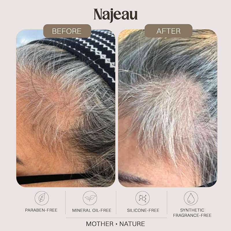 Copper Peptide Scalp Treatment for Thinning Hair - Leave-In Mist with Redensyl, Squalane & Coffee