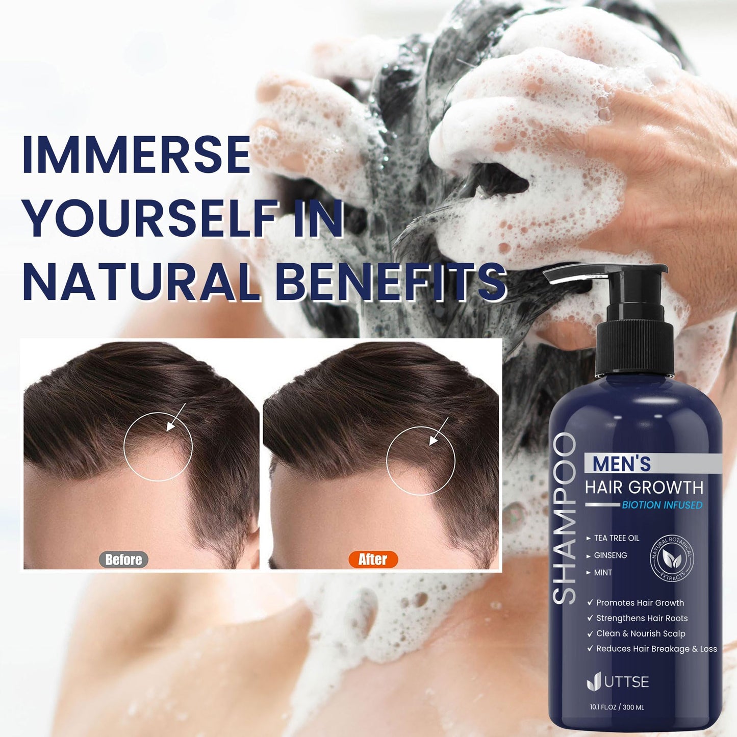 Uttse Biotion Hair Growth Shampoo for Men: Natural Thickening Shampoo with Tea Tree Oil Ginseng Mint for Hair Loss and Thinning Hair - 10.1 fl.oz, Dark Blue