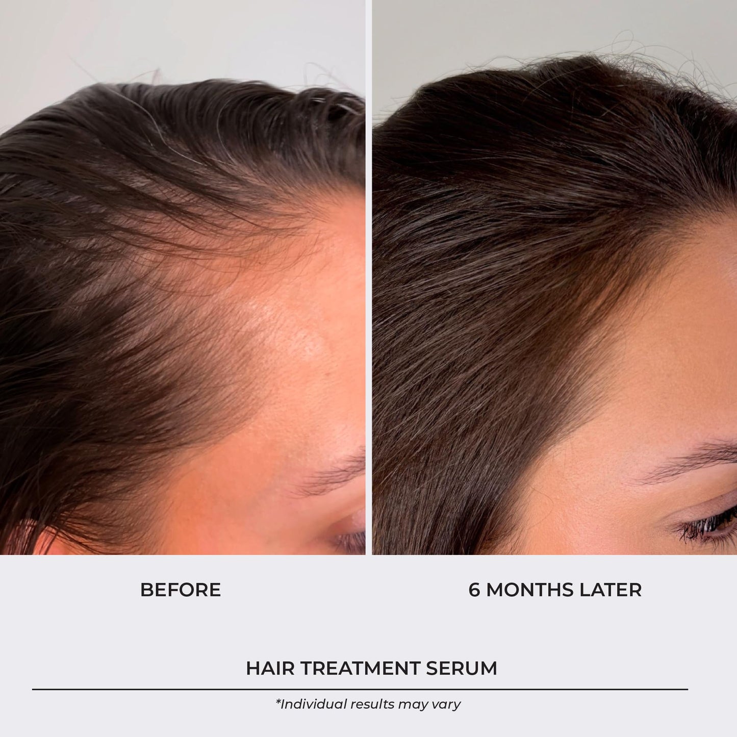 Thickening Hair Growth Serum Women & Men, Biotin Collagen & Rosemary Scalp Serum for Hair Density & Hydrating, Densifying Hair Serum Regrowth Oil for Hair Loss