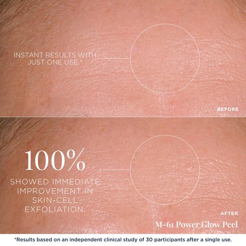 M-61 PowerGlow® Peel- 10 Treatments- 1-minute, 1-step exfoliating glow peel with glycolic, vitamin K & chamomile