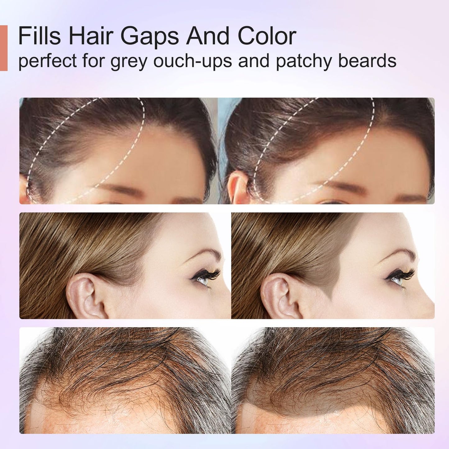 Acomler Instantly Root Touch Up Hairline Shadow Powder,Root Cover Up Hair Color,Dark Brown for Thinning Hair, Grey Hair Coverage Hair Powder for Women with Eyebrows,Beard Line,Bald Spots (Dark Brown)