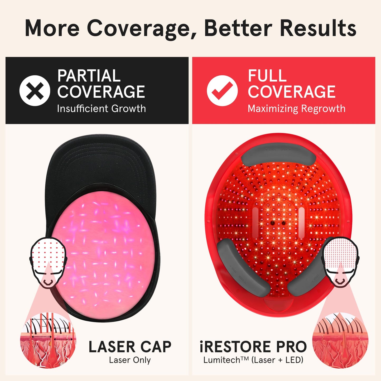 iRestore Professional Laser Red Light Therapy for Hair Growth System - FDA Cleared Hair Loss, Hair Thinning & Alopecia Treatment for Men & Women - 282 Lasers & LEDs