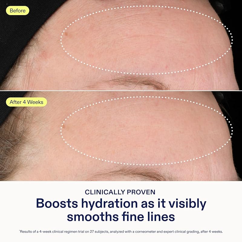 Skinfix Lipid-Hyaluronate Serum, 1 oz — Hydrating Face Serum for Radiance & Fine Line Repair