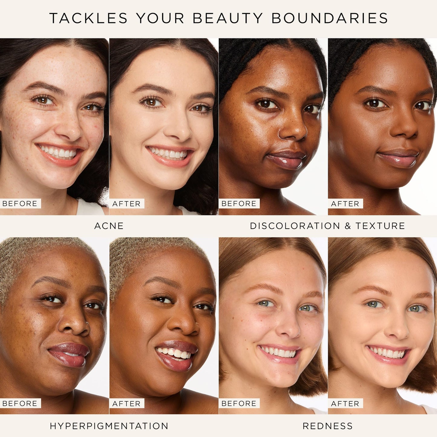 tarte shape tape full-coverage concealer - 22N light neutral (light skin with a balance of warm & cool undertones) - full size