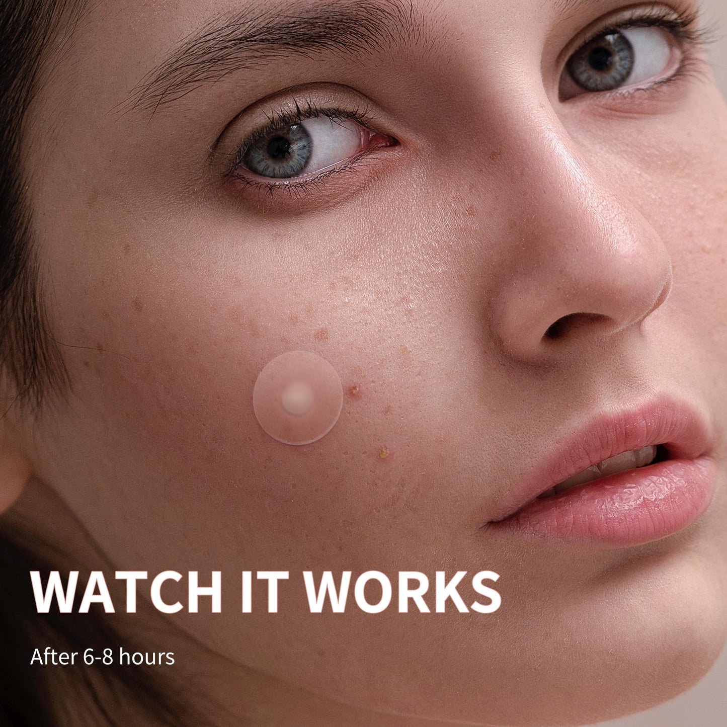 Daolyo Pimple Patches for Face, 4 Size 300 Counts Acne Patches, Hydrocolloid Patches for Covering Zits and Blemishes, Spot Stickers with Salicylic Acid, Tea Tree Oil & Calendula Oil