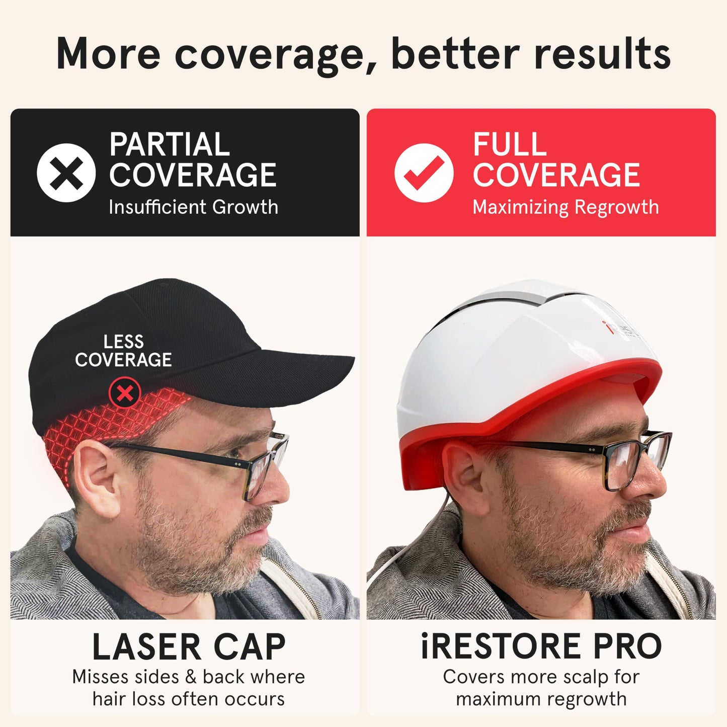 iRestore Professional Laser Red Light Therapy for Hair Growth System - FDA Cleared Hair Loss, Hair Thinning & Alopecia Treatment for Men & Women - 282 Lasers & LEDs