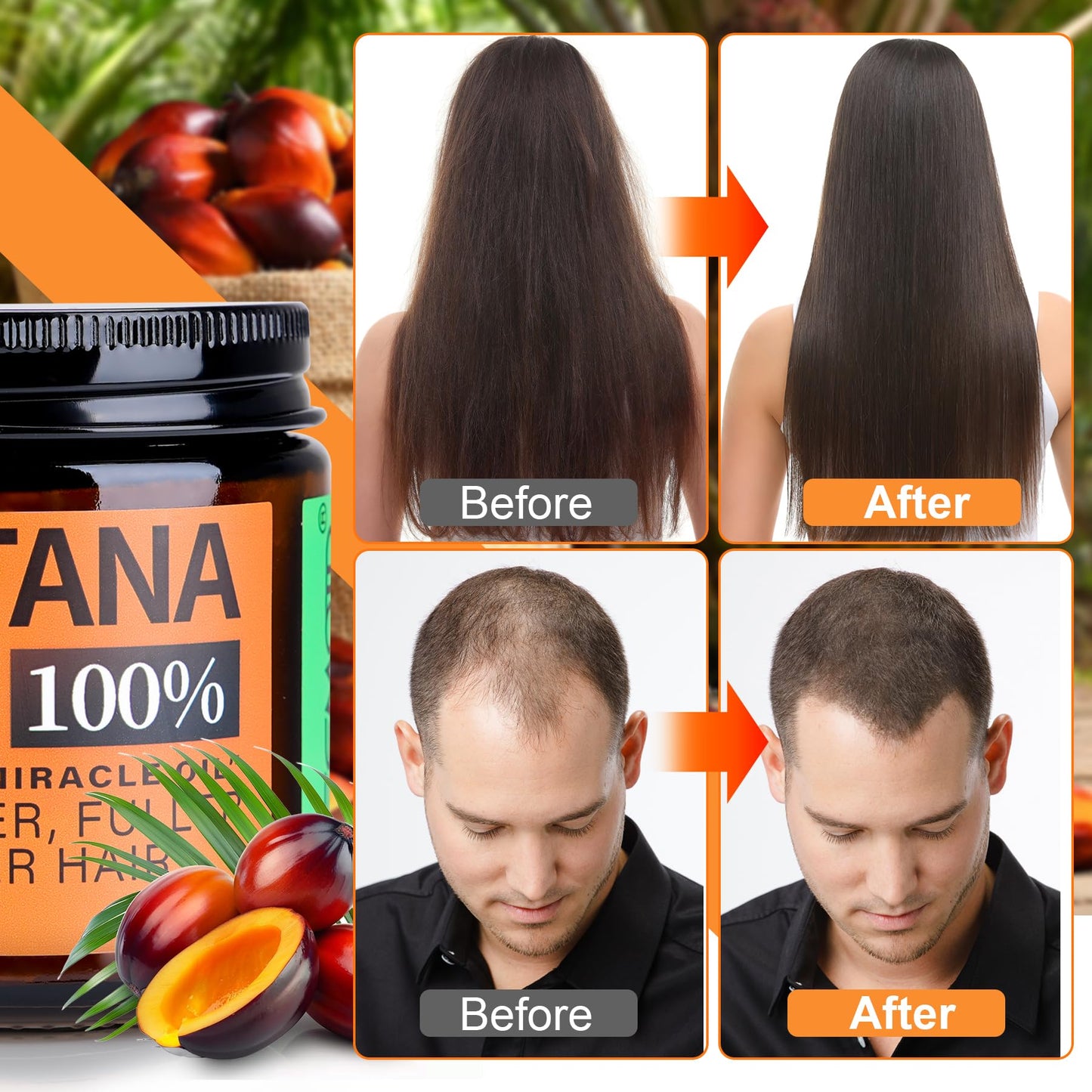 Raw Batana Oil for Hair Growth Dr Sebi, 100% Pure Organic Batana Hair Mask from Honduras, Wild Growth Hair Oil, Scalp Oil Promotes Hair Thickness, Prevents Loss for Men & Women, 4.06 fl oz (1 Pack)