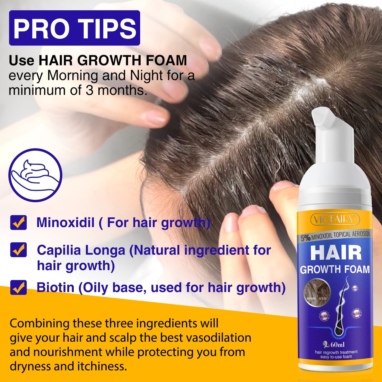 5% Minoxidil Foam for Hair Growth and Thickening - Biotin & Minoxidil Treatment to Stop Thinning & Hair Loss for Men & Women, 2oz