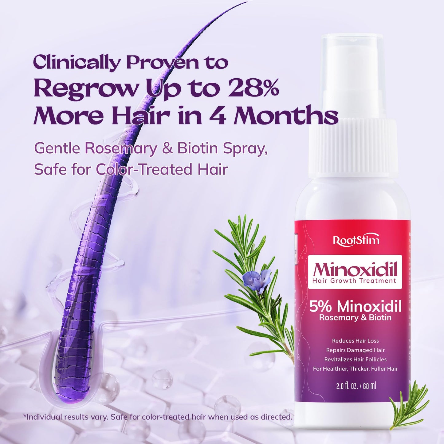 Women's 5% Minoxidil Spray for Hair Growth: RootStim Extra Strength Minoxidil with Rosemary & Biotin for Thinning Hair Regrowth and Fuller Hair 60 ML
