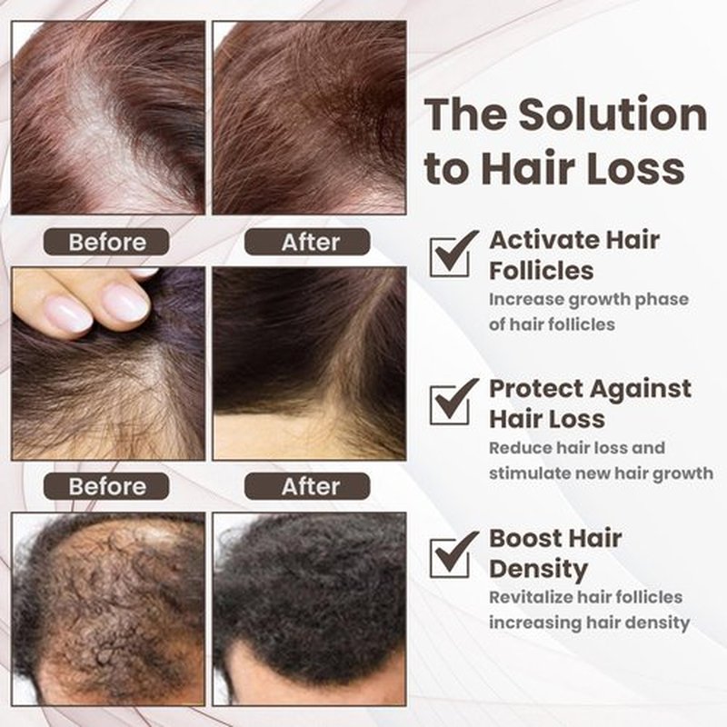 Copper Peptide 10% GHK-CU, 5% AHK-CU peptides Hair Growth Treatment Serum