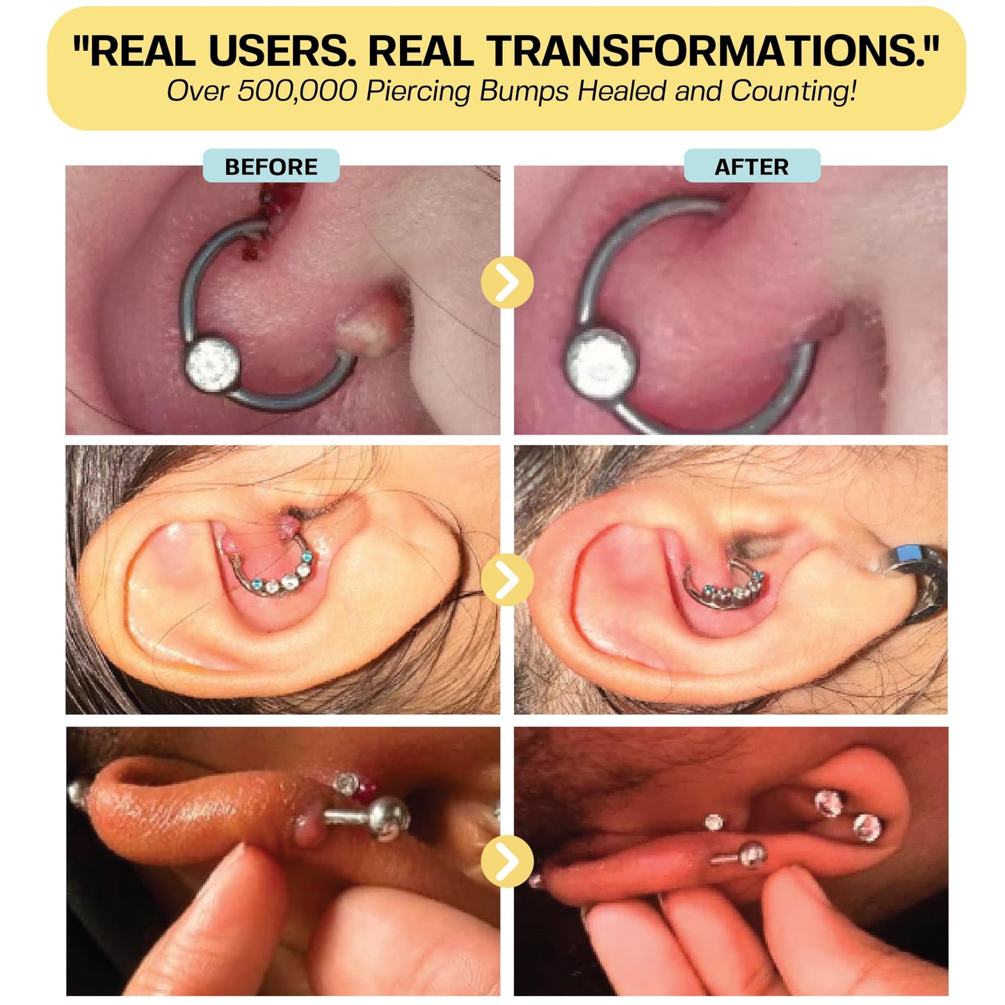 BASE LABORATORIES Keloid Bump Removal Gel | Natural Piercing Bump Treatment & Keloid Scar Gel | Keloid Scar Removal for all Scars, Keloids & Piercing Bumps | Soothing Piercing Aftercare | 2 oz