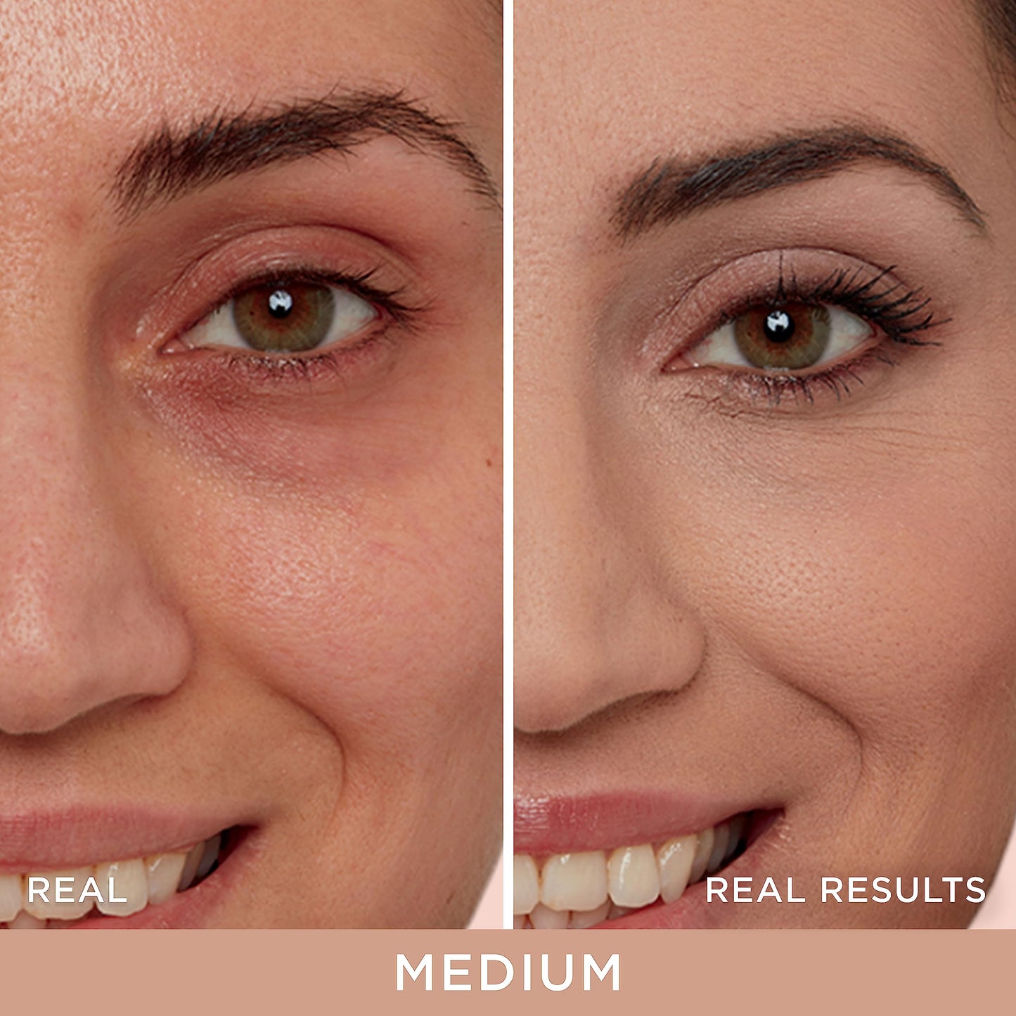 IT Cosmetics Bye Bye Under Eye Concealer (Medium) - Waterproof Full Coverage Concealer For Dark Circles, Fine Lines, Redness & Discoloration, With Hyaluronic Acid, Natural Finish – 0.4 fl oz