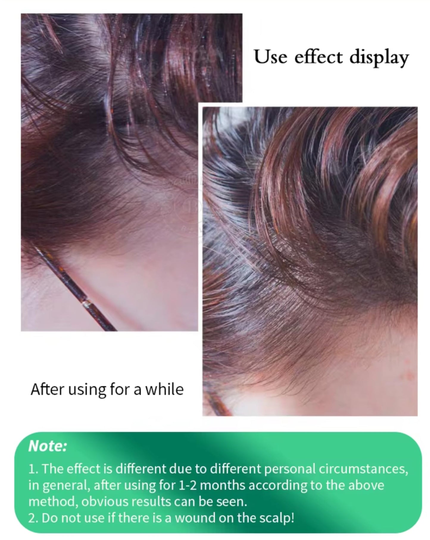 Hair Growth Tonic, Anti Hair Loss Tonic 240 ml (8.1 fl oz)