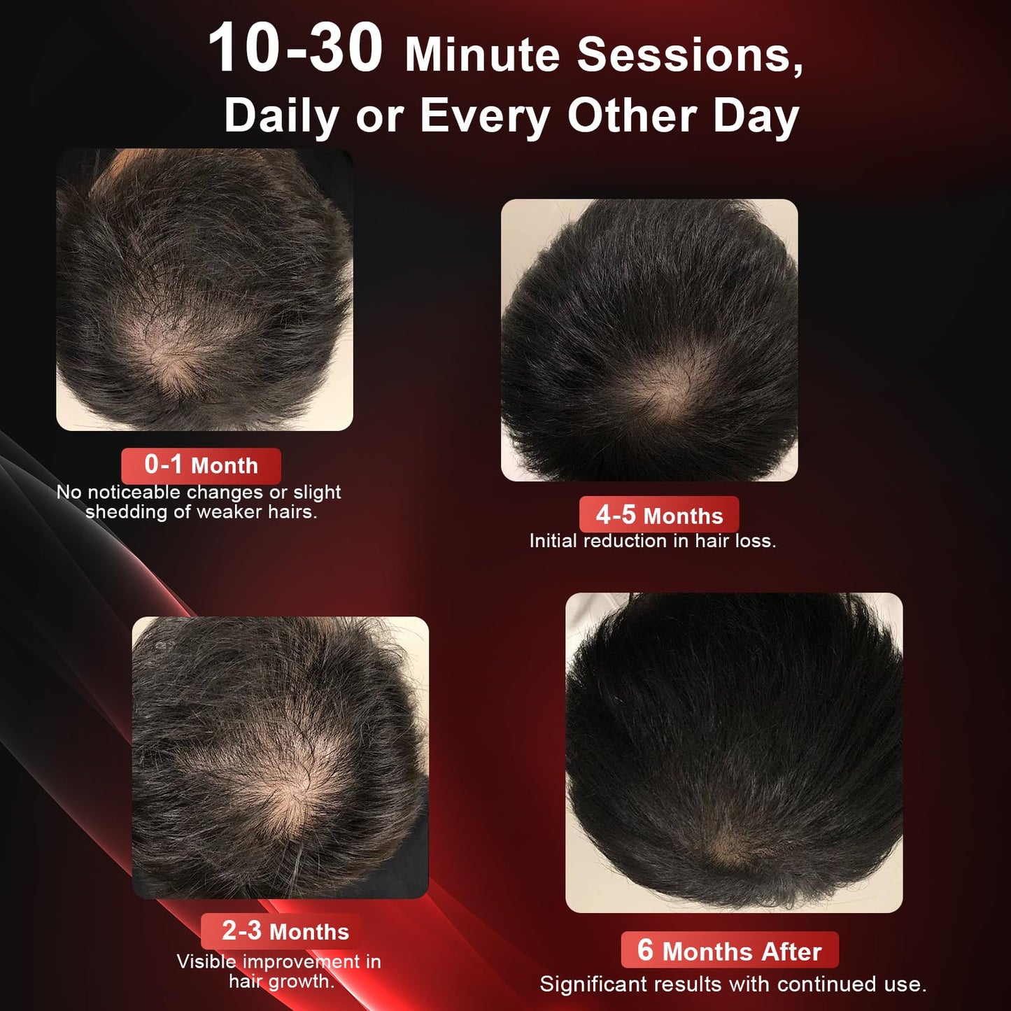 CAYAMA Laser Hair Growth Cap, 510 LEDs Red Light Cap for Fuller Looking Hair & Scalp Support for Men & Women